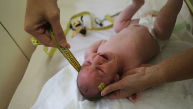 De zika a rubéola: as doenças que podem causar más-formações em fetos