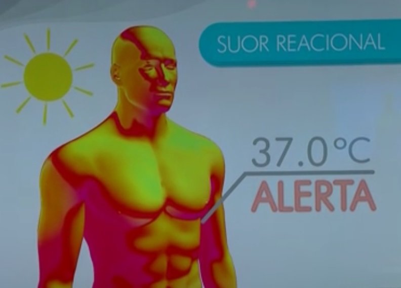 Especialistas falam sobre hiperidrose, suor e roupas adequadas para o verão