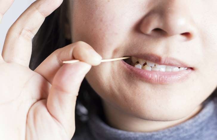 Palitar os dentes, pode ou não pode ?